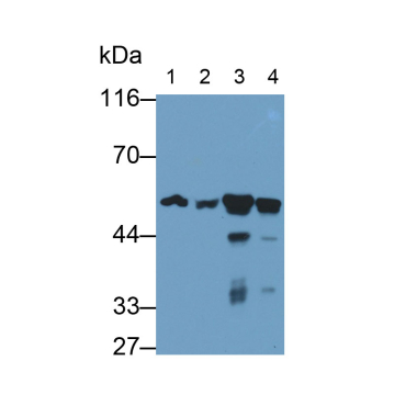 Visfatin (VF) Human Monoclonal Antibody