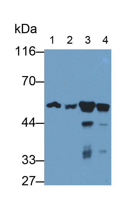 Visfatin (VF) Human Monoclonal Antibody