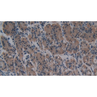 Cross Linked N-Telopeptide Of Type I Collagen (NTXI) Human Monoclonal Antibody