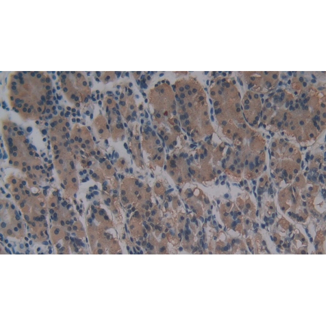 Cross Linked N-Telopeptide Of Type I Collagen (NTXI) Human Monoclonal Antibody