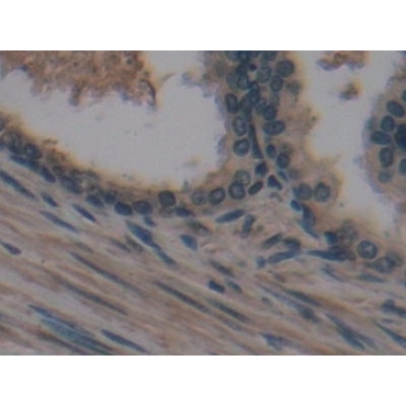 Cross Linked N-Telopeptide Of Type I Collagen (NTXI) Human Monoclonal Antibody