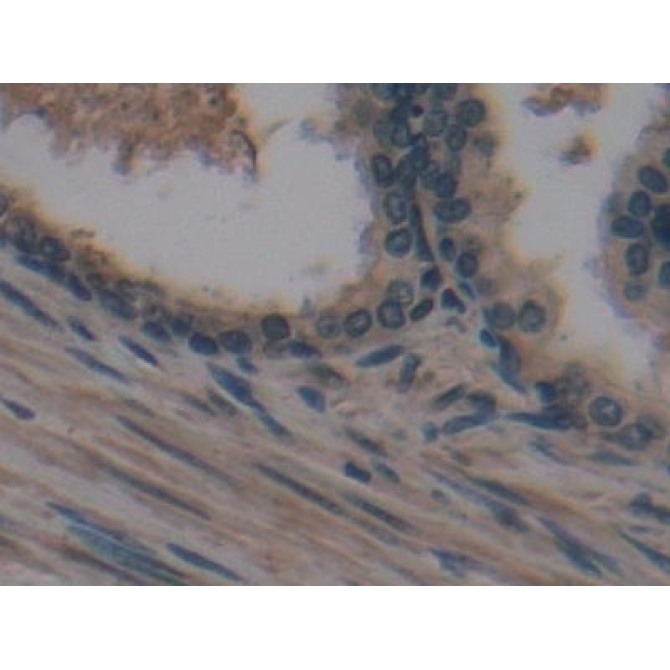 Cross Linked N-Telopeptide Of Type I Collagen (NTXI) Human Monoclonal Antibody