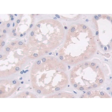 Cross Linked N-Telopeptide Of Type I Collagen (NTXI) Human Monoclonal Antibody
