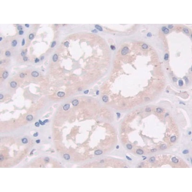 Cross Linked N-Telopeptide Of Type I Collagen (NTXI) Human Monoclonal Antibody