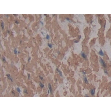 Cross Linked N-Telopeptide Of Type I Collagen (NTXI) Human Monoclonal Antibody