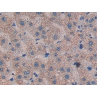 Cross Linked N-Telopeptide Of Type I Collagen (NTXI) Human Monoclonal Antibody