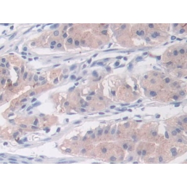Cross Linked N-Telopeptide Of Type I Collagen (NTXI) Human Monoclonal Antibody