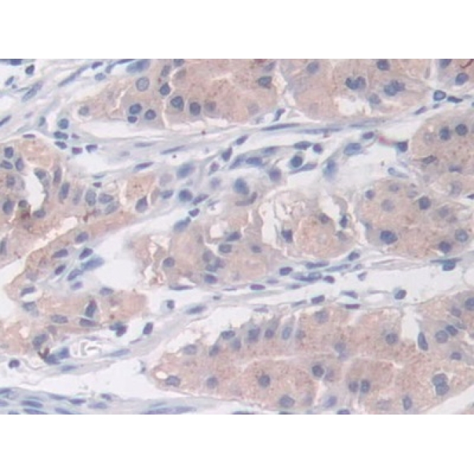 Cross Linked N-Telopeptide Of Type I Collagen (NTXI) Human Monoclonal Antibody