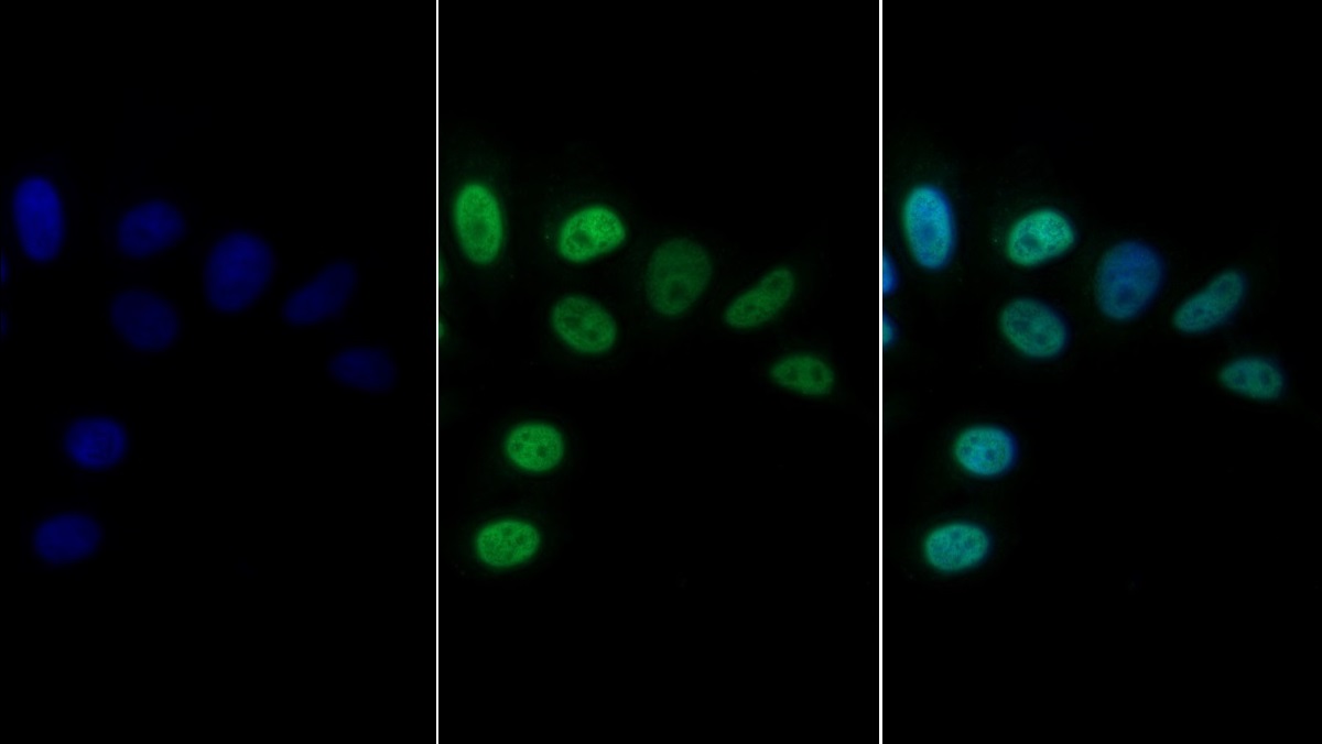 CCAAT/Enhancer Binding Protein Alpha (CEBPa) Rat Monoclonal Antibody
