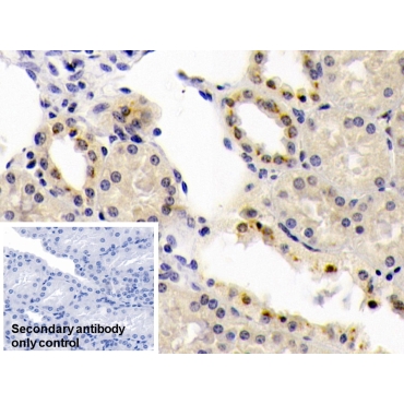 Bone Morphogenetic Protein 6 (BMP6) Human Monoclonal Antibody
