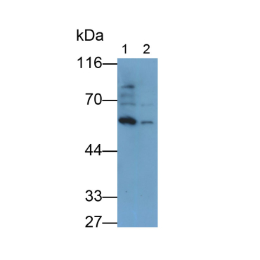 Bone Morphogenetic Protein 6 (BMP6) Human Monoclonal Antibody