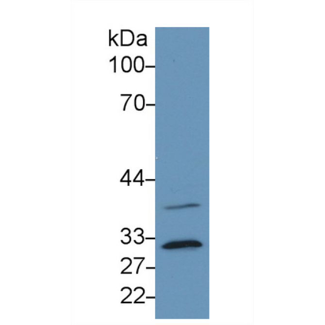 Complement component 1 Q subcomponent-binding protein, mitochondrial (C1QBP) Human Monoclonal Antibody