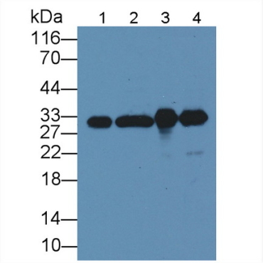 Complement component 1 Q subcomponent-binding protein, mitochondrial (C1QBP) Human Monoclonal Antibody
