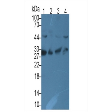 Complement component 1 Q subcomponent-binding protein, mitochondrial (C1QBP) Human Monoclonal Antibody