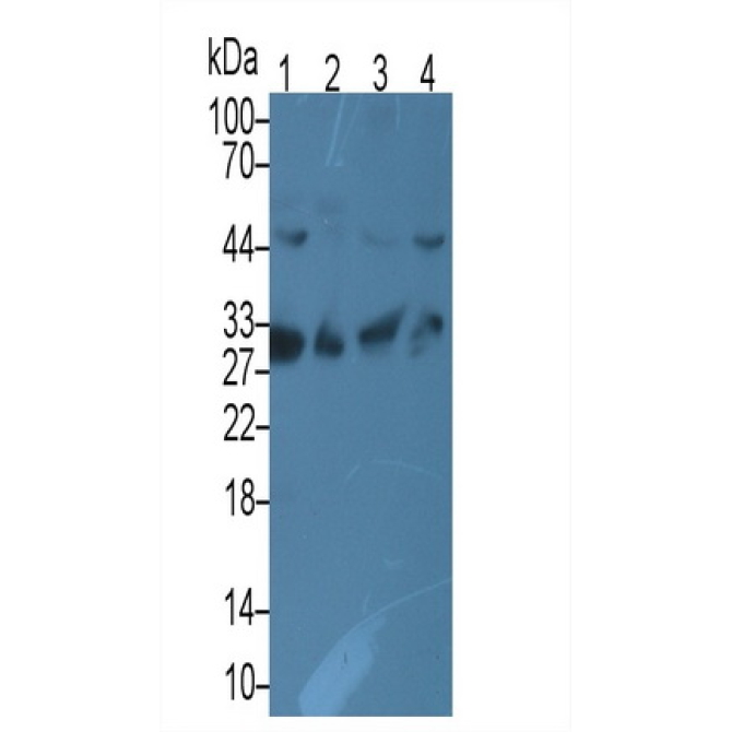 Complement component 1 Q subcomponent-binding protein, mitochondrial (C1QBP) Human Monoclonal Antibody
