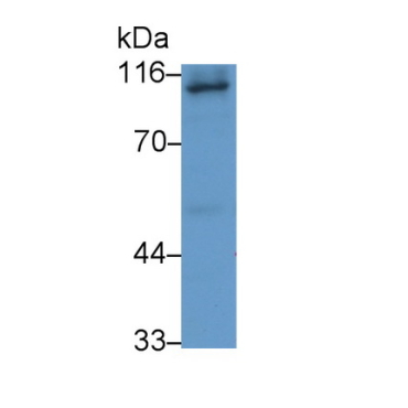 Amiloride Binding Protein 1 (ABP1) Human Monoclonal Antibody