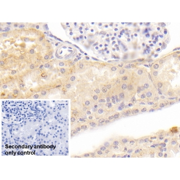 Amiloride Binding Protein 1 (ABP1) Human Monoclonal Antibody