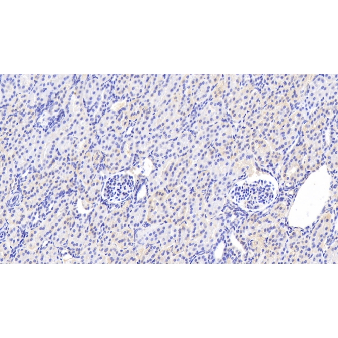 Amiloride Binding Protein 1 (ABP1) Human Monoclonal Antibody