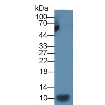 Interleukin 7 (IL7) Human Monoclonal Antibody