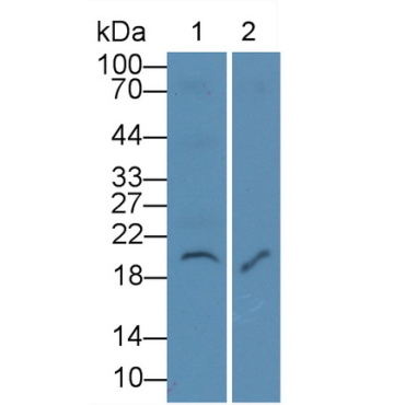 Interleukin 7 (IL7) Human Monoclonal Antibody
