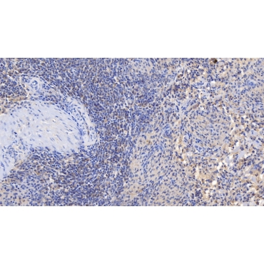 Interleukin 7 (IL7) Human Monoclonal Antibody