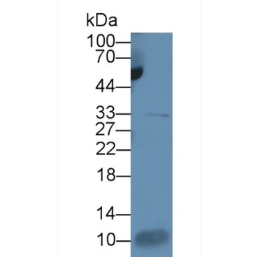 Interleukin 7 (IL7) Human Monoclonal Antibody