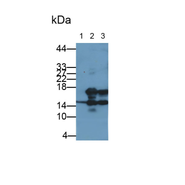Interleukin 7 (IL7) Human Monoclonal Antibody