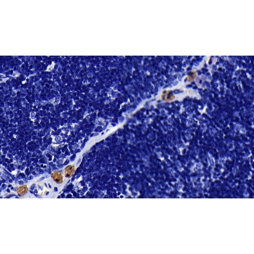 Toll Like Receptor 2 (TLR2) Human Monoclonal Antibody