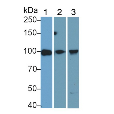 Toll Like Receptor 2 (TLR2) Human Monoclonal Antibody