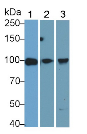 Toll Like Receptor 2 (TLR2) Human Monoclonal Antibody