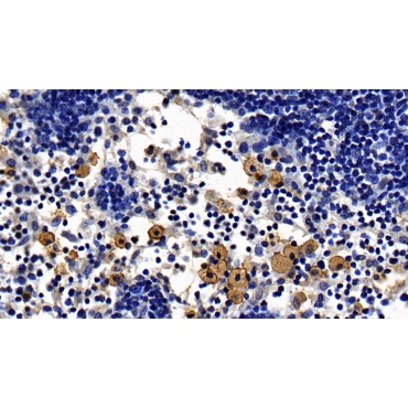 Toll Like Receptor 2 (TLR2) Human Monoclonal Antibody
