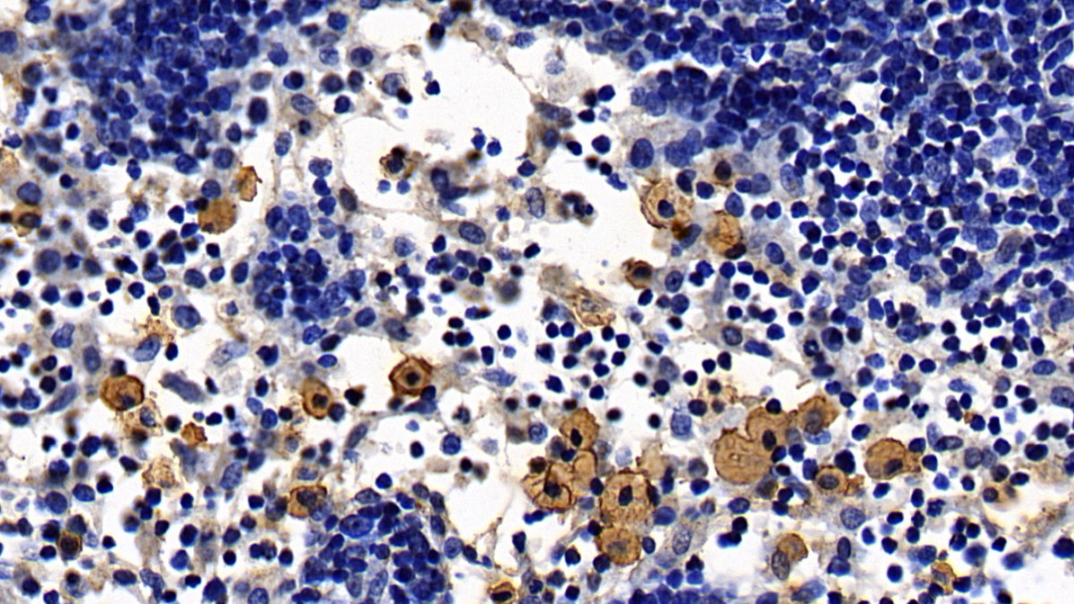 Toll Like Receptor 2 (TLR2) Human Monoclonal Antibody