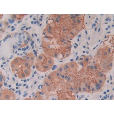 Cross Linked C-Telopeptide Of Type I Collagen (CTXI) Human Monoclonal Antibody