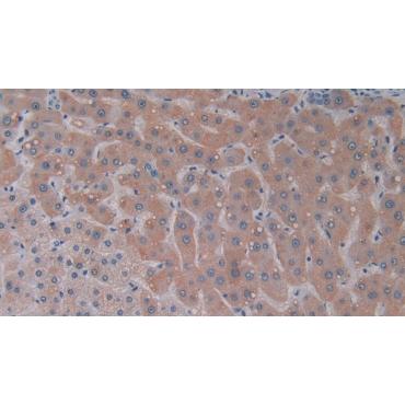 Cross Linked C-Telopeptide Of Type I Collagen (CTXI) Human Monoclonal Antibody