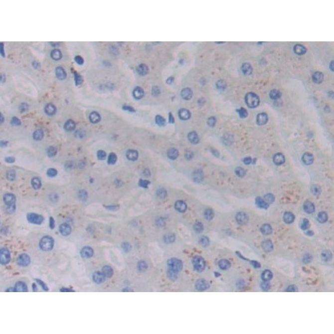 Cross Linked C-Telopeptide Of Type I Collagen (CTXI) Human Monoclonal Antibody