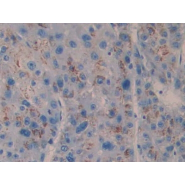 Cross Linked C-Telopeptide Of Type I Collagen (CTXI) Human Monoclonal Antibody