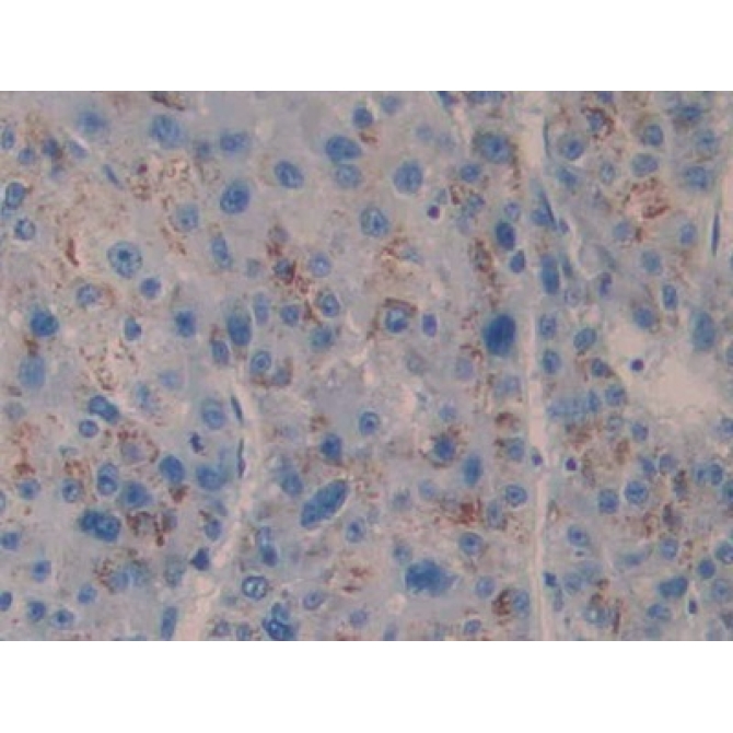Cross Linked C-Telopeptide Of Type I Collagen (CTXI) Human Monoclonal Antibody
