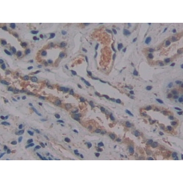 Cross Linked C-Telopeptide Of Type I Collagen (CTXI) Human Monoclonal Antibody