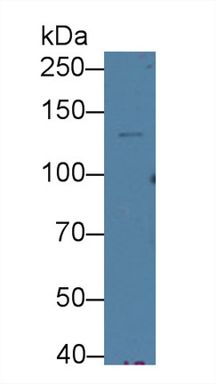 Cross Linked C-Telopeptide Of Type I Collagen (CTXI) Rat Monoclonal Antibody