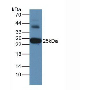Glutathione S Transferase Alpha 3 (GSTa3) Human Monoclonal Antibody