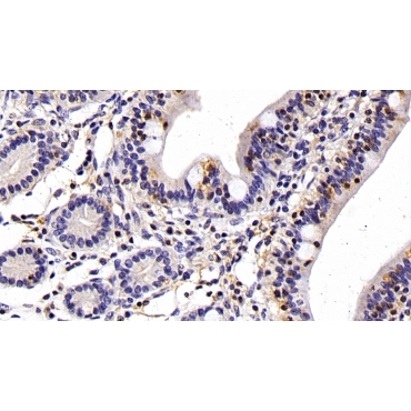 Cluster Of Differentiation 14 (CD14) Human Monoclonal Antibody