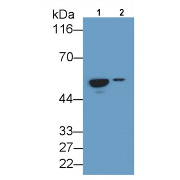 Cluster Of Differentiation 14 (CD14) Human Monoclonal Antibody