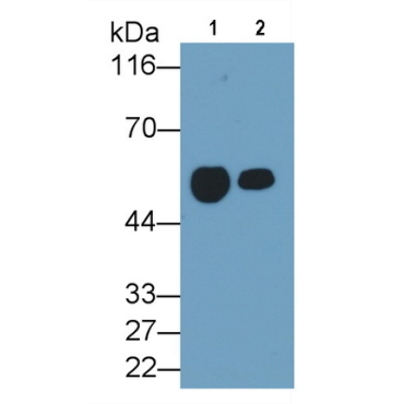 Cluster Of Differentiation 14 (CD14) Human Monoclonal Antibody