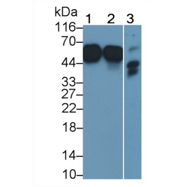 Cluster Of Differentiation 14 (CD14) Human Monoclonal Antibody