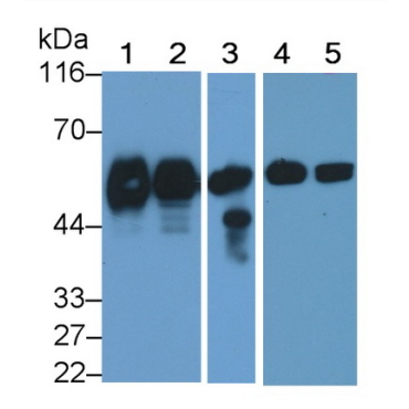 Cluster Of Differentiation 14 (CD14) Human Monoclonal Antibody