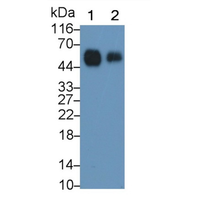 Cluster Of Differentiation 14 (CD14) Human Monoclonal Antibody