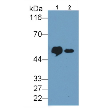 Cluster Of Differentiation 14 (CD14) Human Monoclonal Antibody