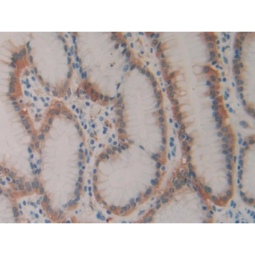 Heat Shock Protein 27 (Hsp27) Human Monoclonal Antibody