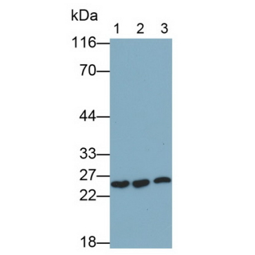 Heat Shock Protein 27 (Hsp27) Human Monoclonal Antibody