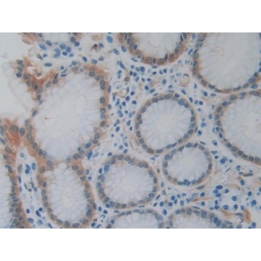 Heat Shock Protein 27 (Hsp27) Human Monoclonal Antibody